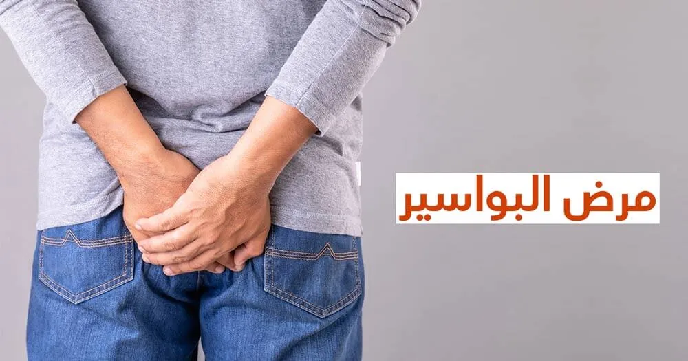 مرض البواسير